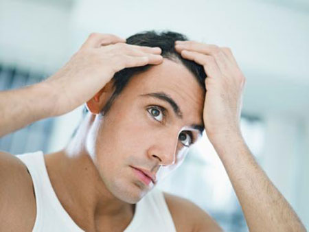 Rụng tóc ở nam giới chữa thế nào
